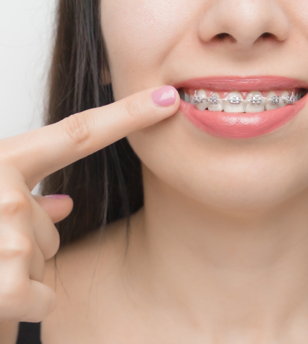 Des appareils plus discrets qu’avant