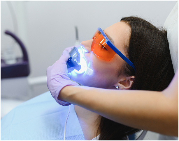 Le blanchiment à la chaise