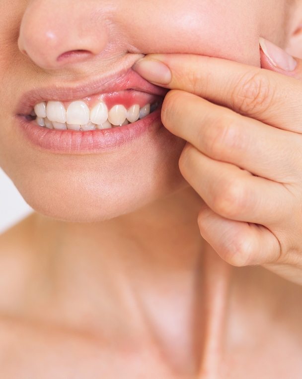 Comprendre les maladies des gencives