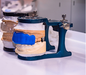 Fabrication de plaque occlusale sur place