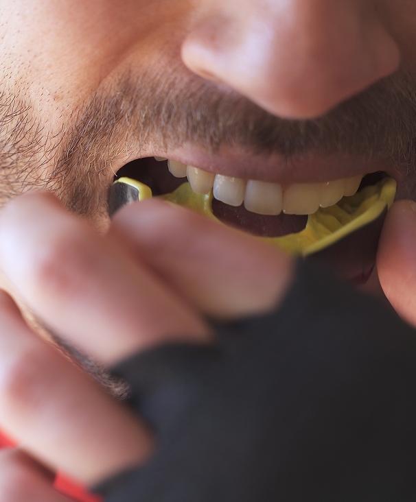 Pourquoi porter un protecteur buccal ?