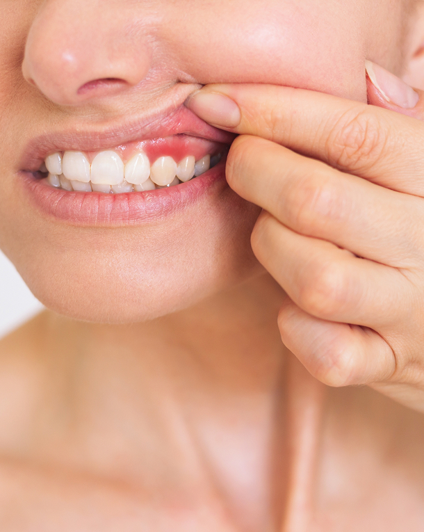 Pourquoi une greffe est-elle nécessaire ?